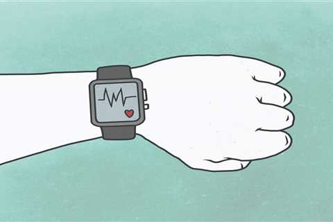 Heartbeat-Tracking Technology Raises Patients’ and Doctors’ Worries