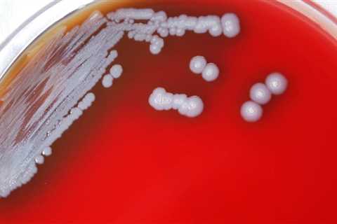 Potentially deadly bacteria discovered on US soil for the first time